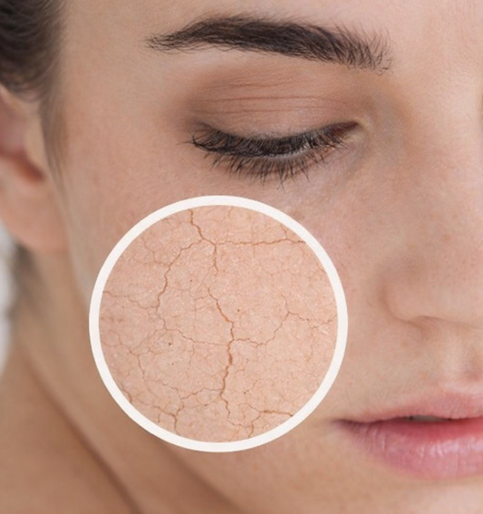 ¿Cuál es la mejor crema para la piel seca y sensible?